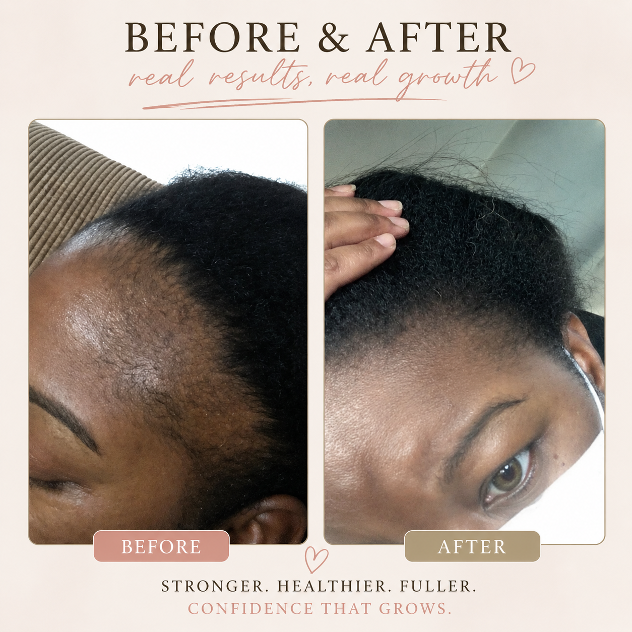 Nourishing Hair Growth Oil
